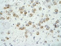 MED17 Rabbit anti-Human, Polyclonal, Novus Biologicals:Antibodies:Primary